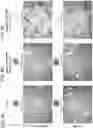 Fig. 09 - Mass spectral tissue analysis