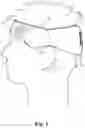 Fig. 02 - PROTECTIVE HEADBAND