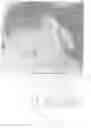 Fig. 11 - Transparent Protective Face Mask