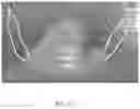 Fig. 14 - Transparent Protective Face Mask