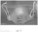 Fig. 15 - Transparent Protective Face Mask