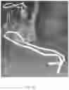 Fig. 17 - Transparent Protective Face Mask