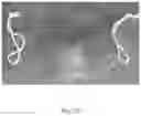 Fig. 24 - Transparent Protective Face Mask