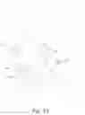 Fig. 31 - Transparent Protective Face Mask