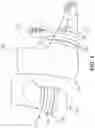 Fig. 02 - Wrap compression system