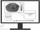 Fig. 01 - Flexible dose estimation with user-defined volumes