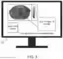 Fig. 04 - Flexible dose estimation with user-defined volumes