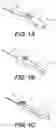 Fig. 02 - Wheel lock for thumbwheel actuated device