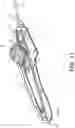 Fig. 15 - Wheel lock for thumbwheel actuated device