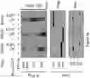 Fig. 06 - Methods and materials for identifying and treating bet inhibitor-resistant cancers