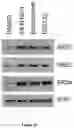 Fig. 09 - Methods and materials for identifying and treating bet inhibitor-resistant cancers