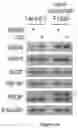 Fig. 120 - Methods and materials for identifying and treating bet inhibitor-resistant cancers