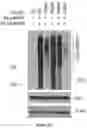 Fig. 15 - Methods and materials for identifying and treating bet inhibitor-resistant cancers