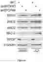 Fig. 33 - Methods and materials for identifying and treating bet inhibitor-resistant cancers