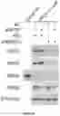 Fig. 44 - Methods and materials for identifying and treating bet inhibitor-resistant cancers