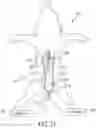 Fig. 25 - Negative pressure therapy system
