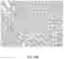 Fig. 28 - Negative pressure therapy system