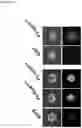 Fig. 14 - GENETIC SELECTION MARKERS BASED ON ENZYMATIC ACTIVITIES OF THE PYRIMIDINE SALVAGE PATHWAY