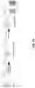 Fig. 53 - ULTRA-SENSITIVE, FAST, PLASMONIC-FLUOR ENHANCED ASSAY FOR SARS-COV-2 IMMUNE RESPONSE