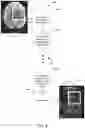 Fig. 07 - Multi-shot echo planar imaging through machine learning