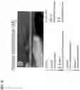 Fig. 20 - Systems, methods, and devices for medical image analysis, diagnosis, risk stratification, decision making and/or disease tracking