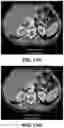 Fig. 59 - Systems, methods, and devices for medical image analysis, diagnosis, risk stratification, decision making and/or disease tracking