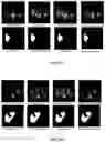 Fig. 08 - Device and method for alignment of multi-modal clinical images using joint synthesis, segmentation, and registration