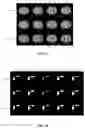 Fig. 09 - Device and method for alignment of multi-modal clinical images using joint synthesis, segmentation, and registration