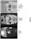 Fig. 10 - DYNAMIC DEPTH DETERMINATION