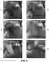 Fig. 04 - Glitch detection system