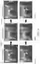 Fig. 12 - System and method for risk classification and warning of flashover events