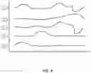 Fig. 04 - System for integrating multiple sensor data to predict a fall risk