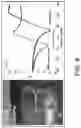 Fig. 14 - Resonant sensor reader
