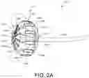 Fig. 03 - OVERLAY OF DYNAMIC SPATIAL DATA ON USER INTERFACE FOR ABLATION BY IRREVERSIBLE ELECTROPORATION