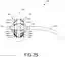 Fig. 04 - OVERLAY OF DYNAMIC SPATIAL DATA ON USER INTERFACE FOR ABLATION BY IRREVERSIBLE ELECTROPORATION