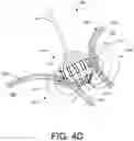 Fig. 09 - OVERLAY OF DYNAMIC SPATIAL DATA ON USER INTERFACE FOR ABLATION BY IRREVERSIBLE ELECTROPORATION
