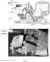 Fig. 10 - Apex bileaflet mechanical valve