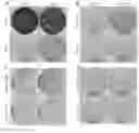 Fig. 08 - Iron chelators in tumor therapy