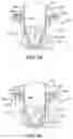 Fig. 05 - System for syringe engagement to an injector