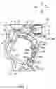 Fig. 02 - Steering wheel core metal