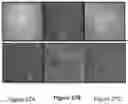 Fig. 22 - TGF-  RECEPTOR II ISOFORM, FUSION PEPTIDE, METHODS OF TREATMENT AND METHODS IN VITRO