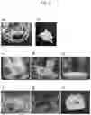 Fig. 04 - Method of collecting bagworm silk thread