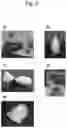 Fig. 06 - Method of collecting bagworm silk thread