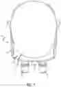 Fig. 08 - LOUPE HAVING ENHANCED SHIELDING