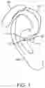 Fig. 02 - Method of determining a status of an acoustic feedback path of a head wearable hearing device and a head wearable hearing device