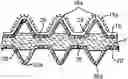 Fig. 01 - COMPOSITE ELASTIC MATERIAL INCLUDING STRUCTURED FILM AND PROCESS FOR MAKING THE SAME