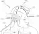 Fig. 01 - HEAD-MOUNTABLE APPARATUS