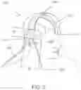 Fig. 03 - HEAD-MOUNTABLE APPARATUS