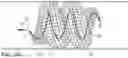 Fig. 10 - Micro-macro endovascular occlusion device and methodology