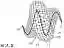 Fig. 11 - Micro-macro endovascular occlusion device and methodology